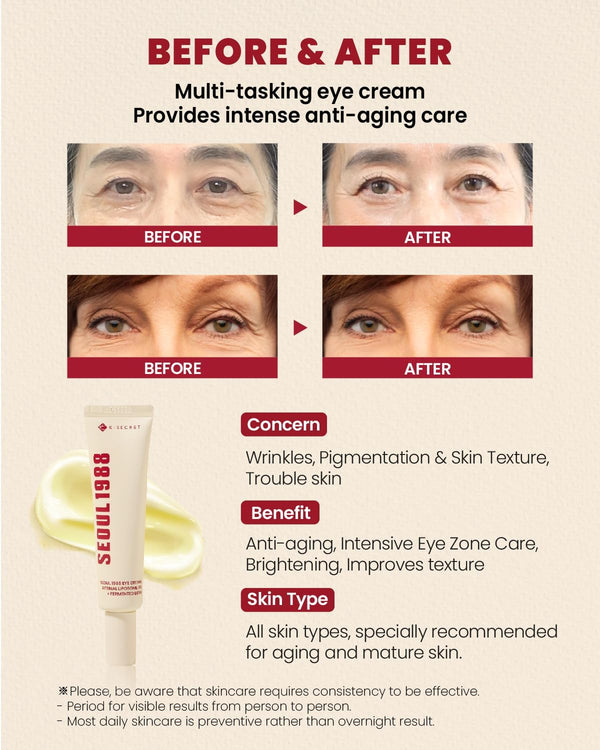 ksecret ksecret Eye Cream Seoul 1988 with Retinal 30ml